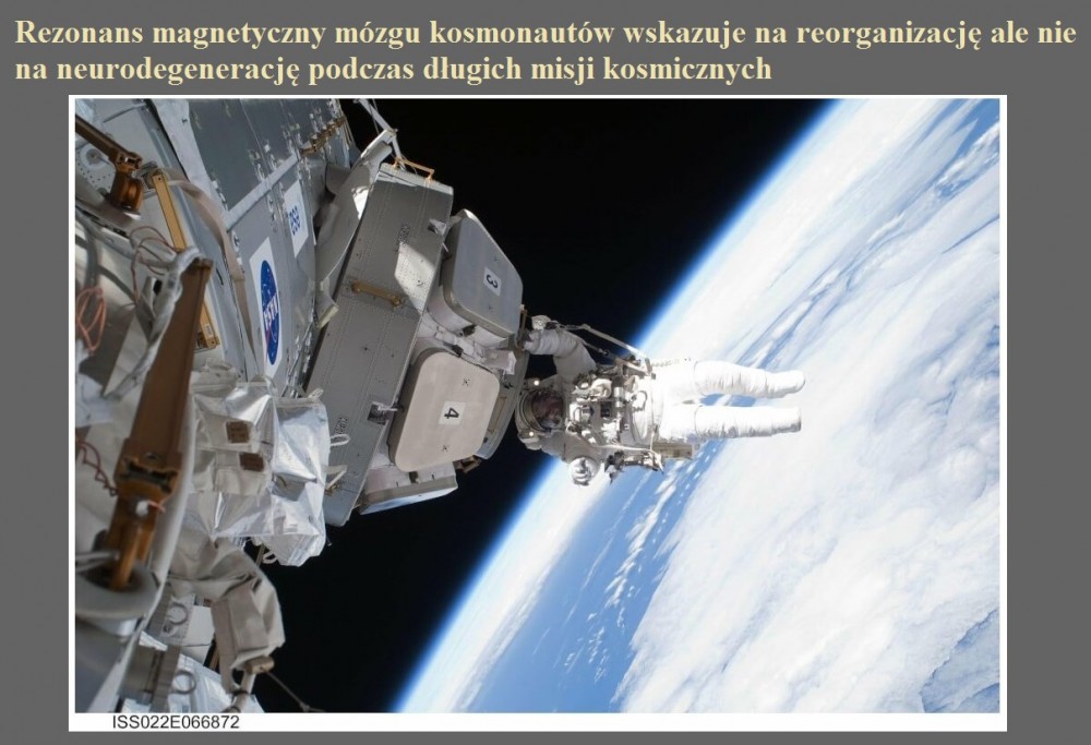 Rezonans magnetyczny mózgu kosmonautów wskazuje na reorganizację ale nie na neurodegenerację podczas długich misji kosmicznych.jpg